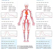 Vascular system diagram with waveform analysis